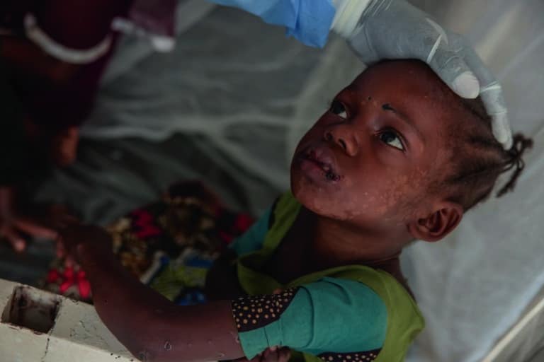 En vidéo 6 Mpox malade bebe RDC